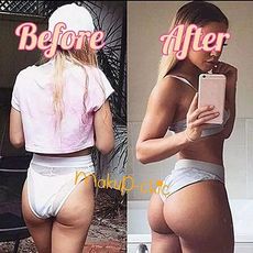 PACK Aide à redresser la forme et à raffermir le derrière PLUS Fullips Gonfle lèvres GRATUIT au meilleur prix au Maroc