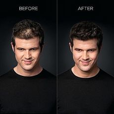 Toppik Fibres capillaires Pour Cheveux Endommagé Toppik 27,5 g au meilleur prix au Maroc