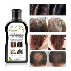 Shampoing ANTI HAIR LOSS au meilleur prix au Maroc