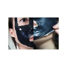 Masque Noir Carbone pour Eliminer l'Acné et les Points Noirs au meilleur prix au Maroc