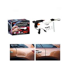 Kit reparation Carrosserie de voiture universel Pops a Dent -MZ.LUX au meilleur prix au Maroc