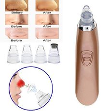 Aspirateur Point Extracteur Point Noir Electrique Avec Base Rechargeable Blackhead Remover au meilleur prix au Maroc