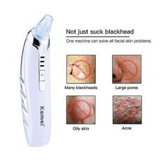 Appreil exfoliant visage anti points noirs au meilleur prix au Maroc