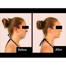 Neckline Slimmer  Menton Minceur Fini Le Double Menton au meilleur prix au Maroc