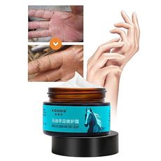 Crème Anti-les gerçures Antibactérien déplacement de Cicatrice Crème Éclaircissante Pour La Peau Blanchissant La Peau Du Pied Hydratant 100ML au meilleur prix au Maroc