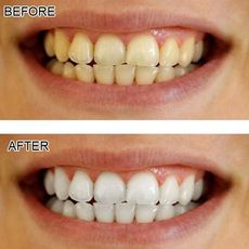 Charbon Actif Dents Blanchiment Organique Naturel de Charbon  Dentifrice Poudre au meilleur prix au Maroc