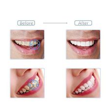 1PCS Nettoyage Blanchiment Des Dents L'hygiène Poudre Nature Charbon au meilleur prix au Maroc