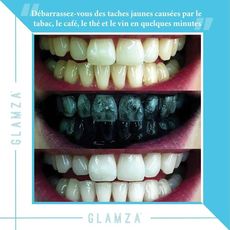 Charbon Actif Dents Blanchiment Organique Naturel de Charbon  Dentifrice Poudre au meilleur prix au Maroc