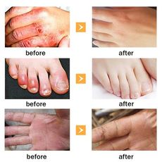 1 pièces FEET WAX FOR MEN Cheval Huile Soins Des Pieds Crème Anti-les gerçures Antibactérien déplacement de Cicatrice Crème Éclaircissante Pour La Peau Blanchissant La Peau Du Pied Hydratant Adoucir au meilleur prix au Maroc