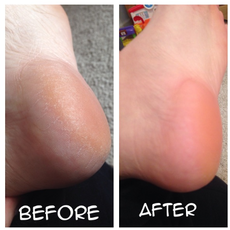 APPAREIL DE NETTOYAGE DES PIEDS ORIGINALE WET/DRY au meilleur prix au Maroc