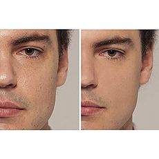 L'orèal Paris Correcteur LOrÈal Paris - Anti-cernes - True Match - 2R/C Rose Vanilla au meilleur prix au Maroc