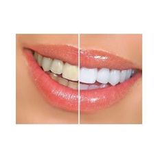 Stylo Blanchiment Des Dents Instantané - Dazzling White - Stylo Applicateur Original au meilleur prix au Maroc