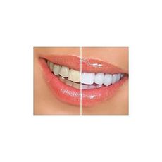 Stylo Blanchiment des dents instantané - Dazzling White - Stylo Applicateur au meilleur prix au Maroc