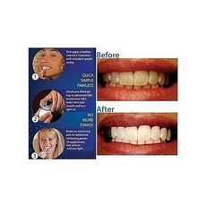 White Light Smile au meilleur prix au Maroc