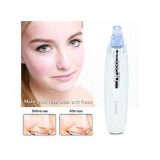 Aspirateur points noirs 6 en 1 - rechargeable - pour femmes et hommes - blanc - Qualité Supérieur au meilleur prix au Maroc