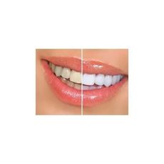 Stylo Blanchiment des dents instantané - Dazzling White - Stylo Applicateur au meilleur prix au Maroc