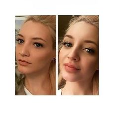 Fullips Rend les lèvres pulpeuses - Kit de 3 pièces au meilleur prix au Maroc