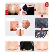 Masque  Carbone Noir pour Éliminer l'Acné et les Points Noirs au meilleur prix au Maroc