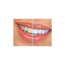 Stylo Blanchiment des dents au meilleur prix au Maroc