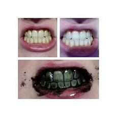 Charbon De Bambou Dent Poudre 100% Naturel Activé Carbone Forte Formule Dentaire Blanchiment Noir Poudre De Nettoyage au meilleur prix au Maroc