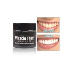 Original MIRACLE TEETH: Blanchissant dents charbon actif en poudre biologique au meilleur prix au Maroc