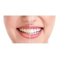 20 Minute Dental White système au meilleur prix au Maroc