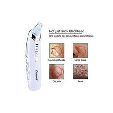 Aspirateur points noirs 6 en 1 - rechargeable - pour femmes et hommes - blanc - Qualité Supérieur au meilleur prix au Maroc