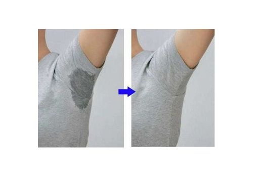 12 Pièces Absorbant pour Aisselle - Anti Transpiration au meilleur prix au Maroc