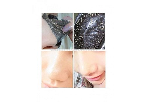 As Seen On TV Black Masque Anti points noir - Rose au meilleur prix au Maroc