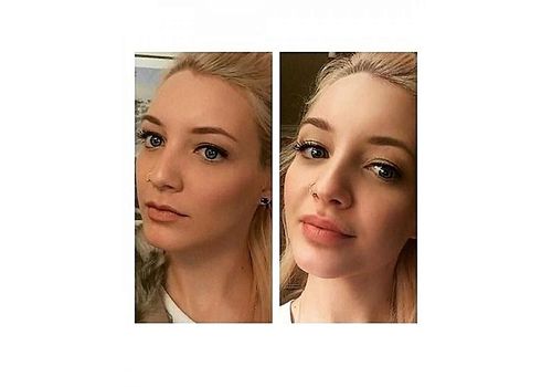 Fullips Rend les lèvres pulpeuses - Kit de 3 pièces au meilleur prix au Maroc