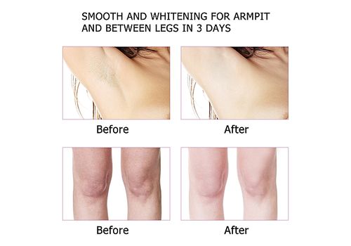 Aichun beauty Creme blanchissante naturelle pour les aisselles, creme desodorisant eclaircissante pour les aisselles, creme pour le corps, aisselles les jambes, les genoux, les zones sensibles au meilleur prix au Maroc