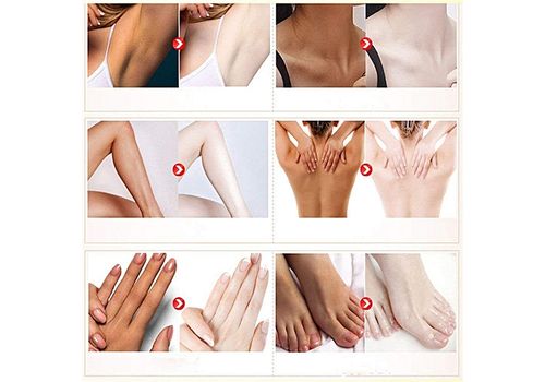 Aichun beauty Creme blanchissante naturelle pour les aisselles, creme desodorisant eclaircissante pour les aisselles, creme pour le corps, aisselles les jambes, les genoux, les zones sensibles au meilleur prix au Maroc