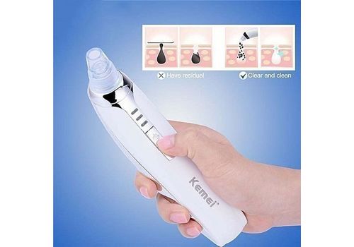 Appreil exfoliant visage anti points noirs au meilleur prix au Maroc