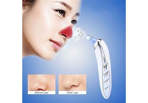 Appareil exfoliant visage anti-points noirs au meilleur prix au Maroc