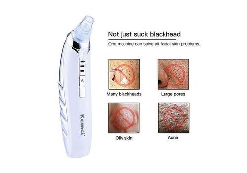 Appareil exfoliant visage anti-points noirs au meilleur prix au Maroc