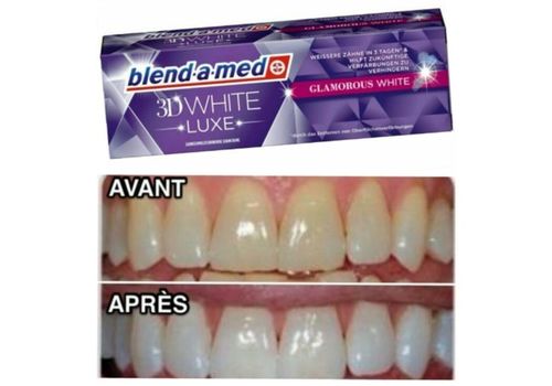 Dentifrice 3D white luxe glamorous white authentique made in germany 75ml au meilleur prix au Maroc