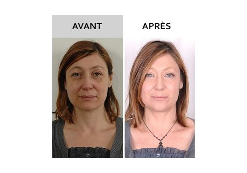 Gel d'escargot Original anti tache - ride - vergetures - acnés et cicatrices pour ts types de peau 50ml au meilleur prix au Maroc