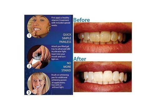 Dental White systeme au meilleur prix au Maroc