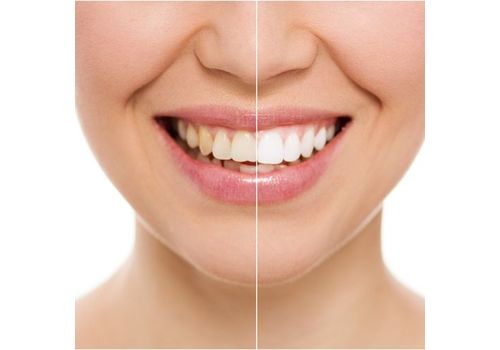 Charbon Actif Dents Blanchiment Organique Naturel de Charbon  Dentifrice Poudre au meilleur prix au Maroc