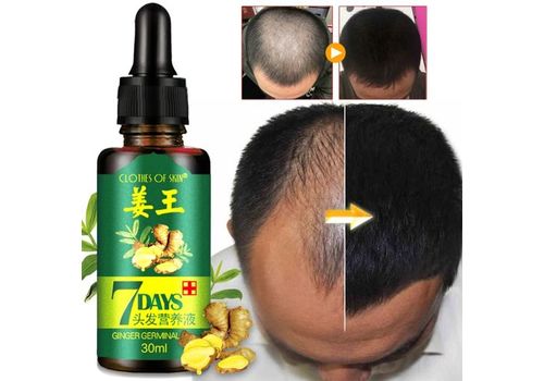 Huile Essentielle Soins Des Cheveux - 30 ml au meilleur prix au Maroc