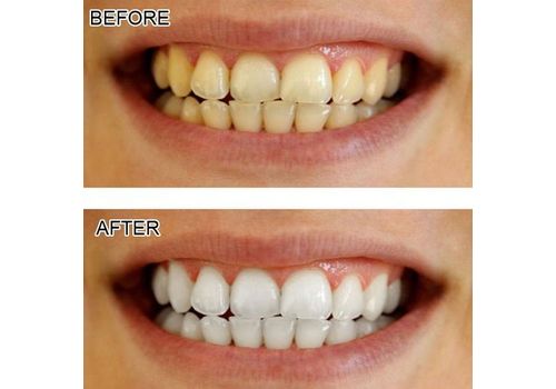 Charbon Actif Dents Blanchiment Organique Naturel de Charbon  Dentifrice Poudre au meilleur prix au Maroc