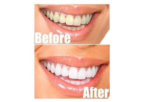 Blanchiment des dents charbon végétal spécial blanchiment dentaire - à l'huile essentielle de la menthe Effet fraîcheur - blanchir ses dent au naturel au meilleur prix au Maroc