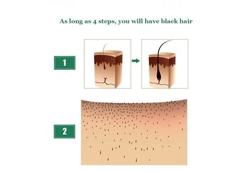 Huile Essentielle Soins Des Cheveux - 30 ml au meilleur prix au Maroc