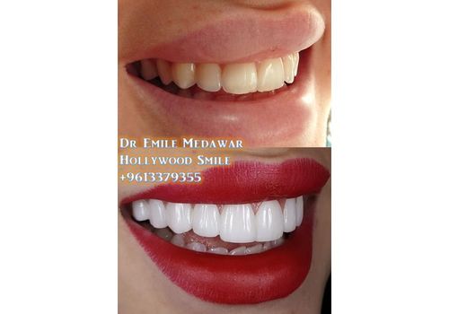 Charbon Actif Dents Blanchiment Organique Naturel de Charbon  Dentifrice Poudre au meilleur prix au Maroc