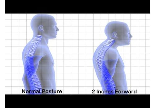 ORIGINALE ROYAL POSTURE-CORRECTEUR DE POSTURE au meilleur prix au Maroc