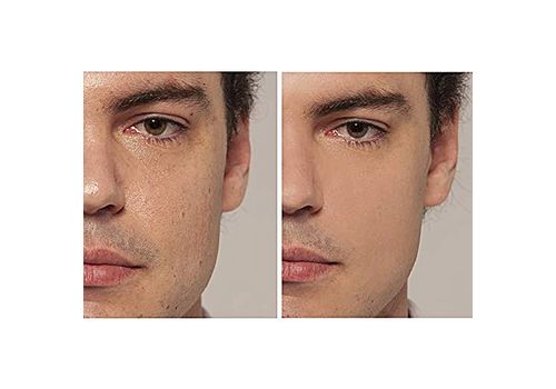 L'orèal Paris Correcteur LOrÈal Paris - Anti-cernes - True Match - 2R/C Rose Vanilla au meilleur prix au Maroc