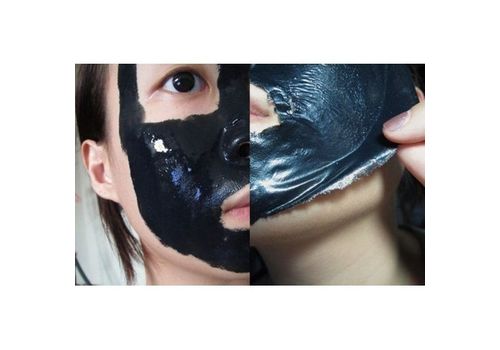Masque Noir carbone pour éliminer l'acné et les points noirs au meilleur prix au Maroc