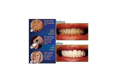 White Light Smile au meilleur prix au Maroc