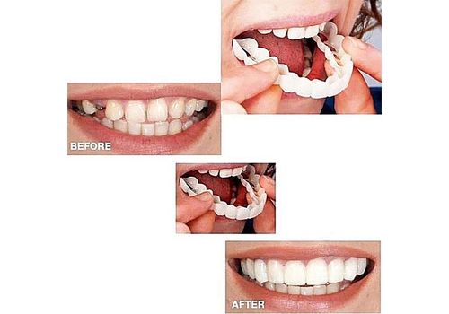 Prothèse Ajustement Flex Cosmétique Dents au meilleur prix au Maroc