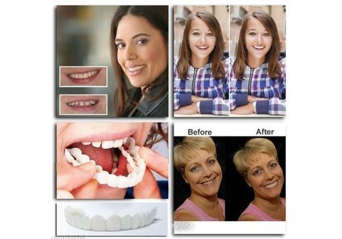 Snap on Smile parfait sourire blanchiment des dents au meilleur prix au Maroc